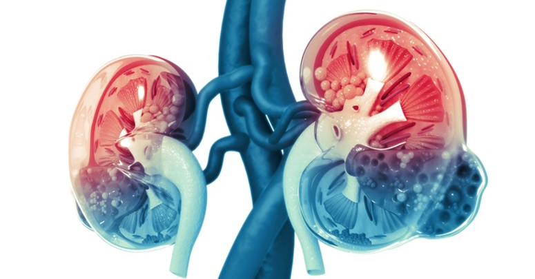 Gangguan Ginjal Akut (Acute Kidney Injury)