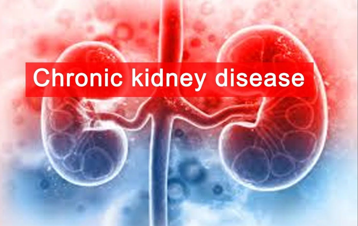 Penyebab Penyakit Ginjal Kronik (Chronic Kidney Disease)